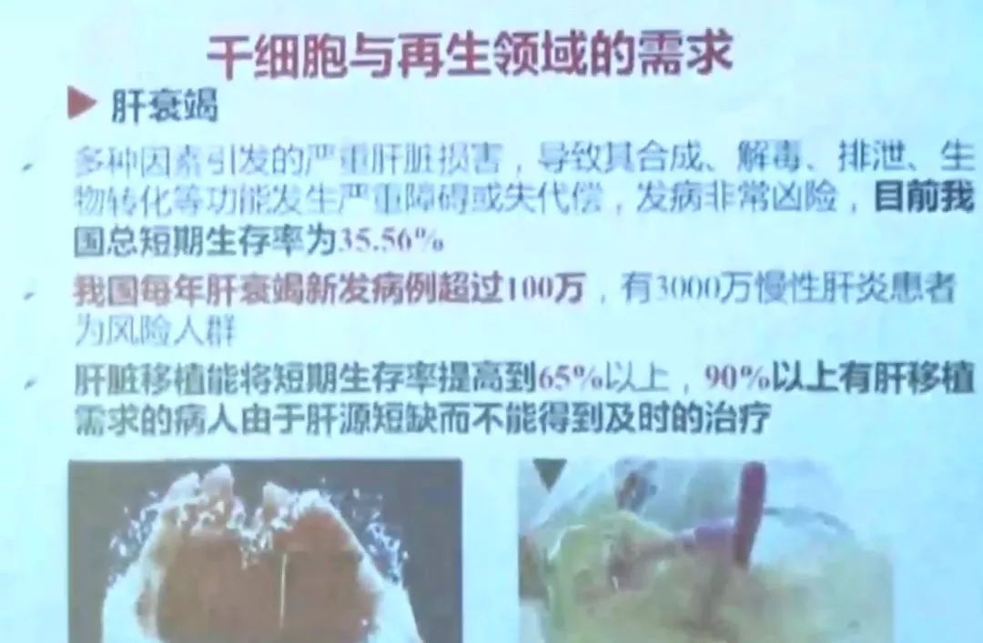 实验报告，比较绒毛和针毛的特性